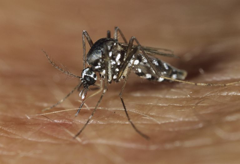 5 Comparaciones entre las paperas y el virus del Zika