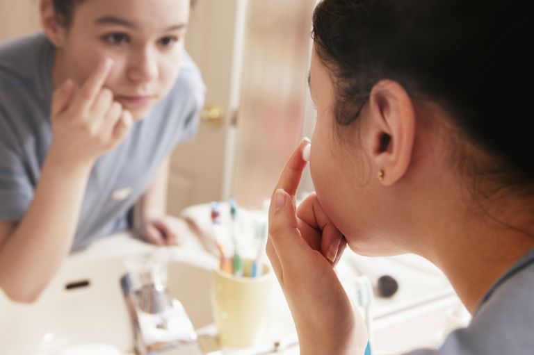 5 Maneras de preservar su autoestima a pesar del acné