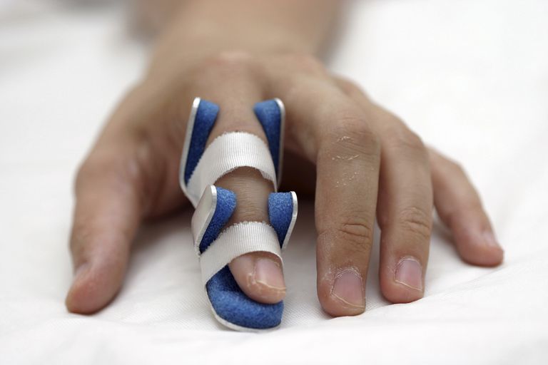 9 Causas comunes de lesiones en los dedos