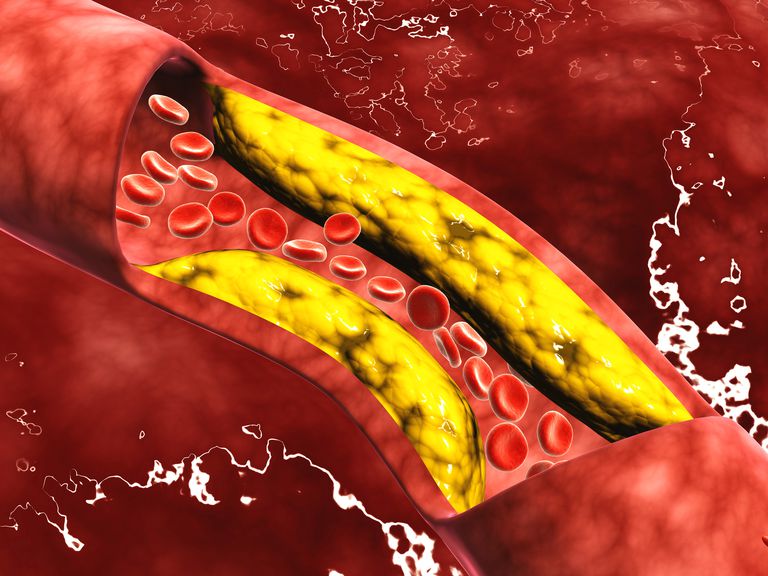 Un examen de la hipótesis del colesterol