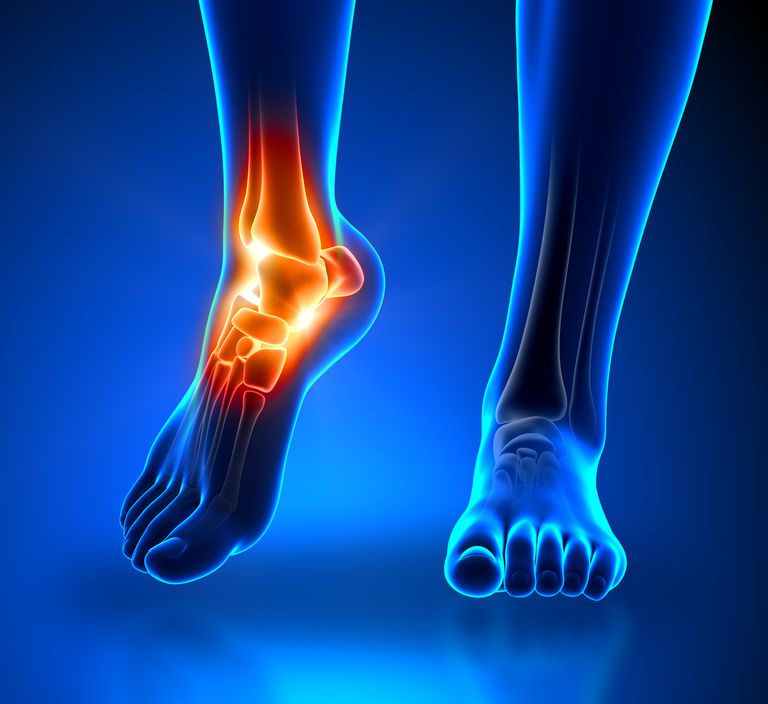 ¿Los problemas nerviosos son los causantes del dolor en el pie?