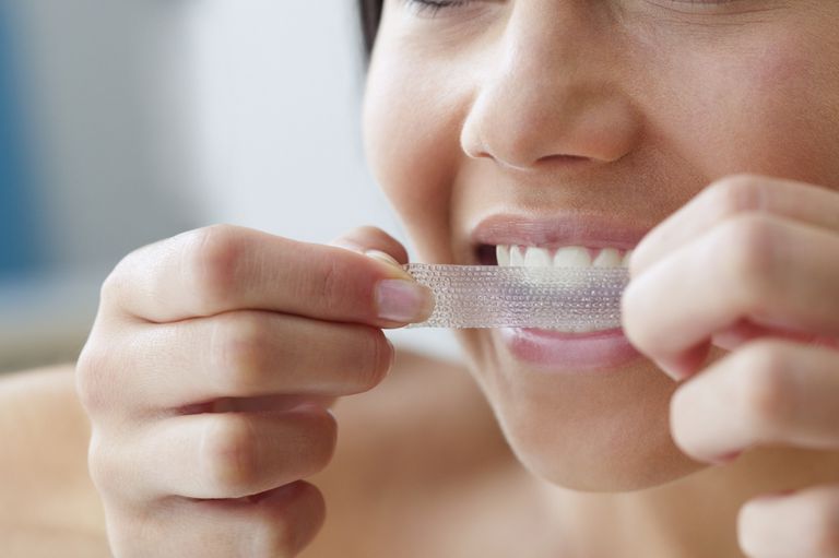 ¿Hay efectos secundarios por blanquear los dientes?