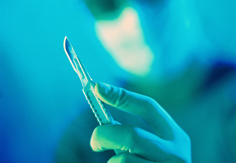 ¿Puede la circuncisión reducir el riesgo de un hombre de contraer el VIH?
