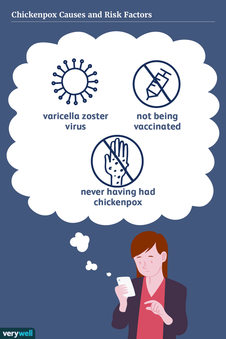 Causas y factores de riesgo de la varicela