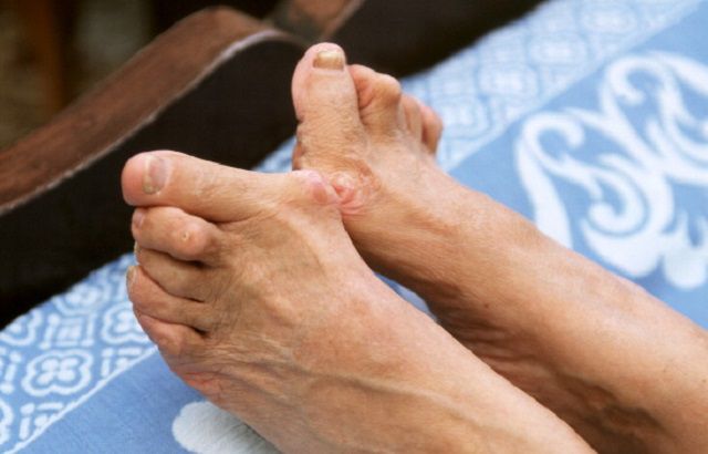 Causas del dolor en la articulación del dedo gordo del pie