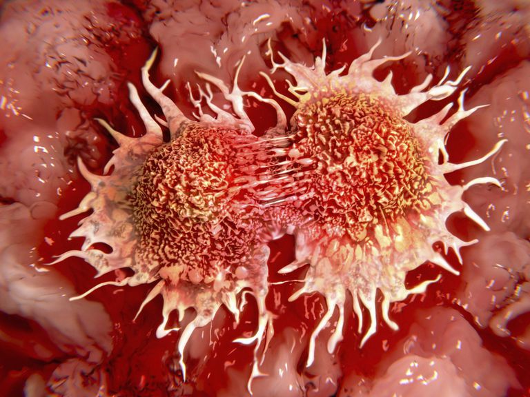 Una mirada más cercana a los 5 cánceres más mortales