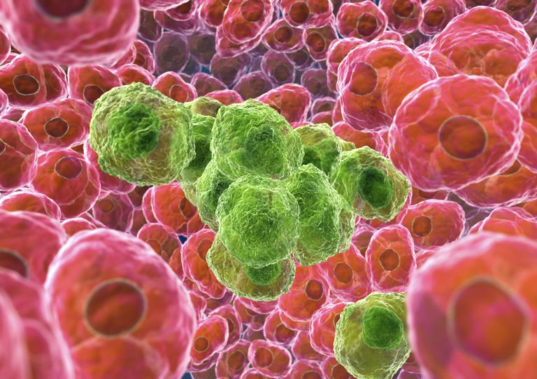 ¿El VPH causa cáncer de pulmón? Causation vs Correlation