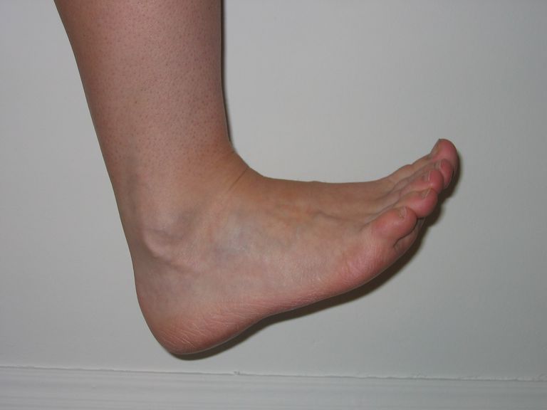 Ejercicios de pie y tobillo para recuperación y prevención de lesiones