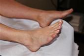 Consejos para el cuidado de los pies para personas con artritis