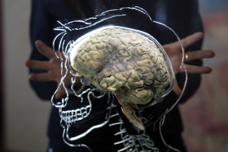 Los lóbulos frontales: lo que nos hace humanos
