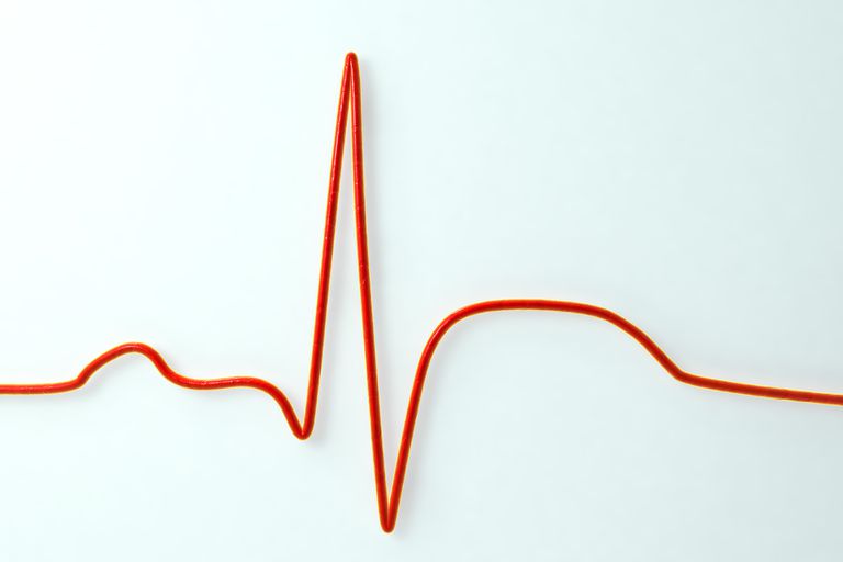 Ataque cardíaco vs. Ataque cardíaco