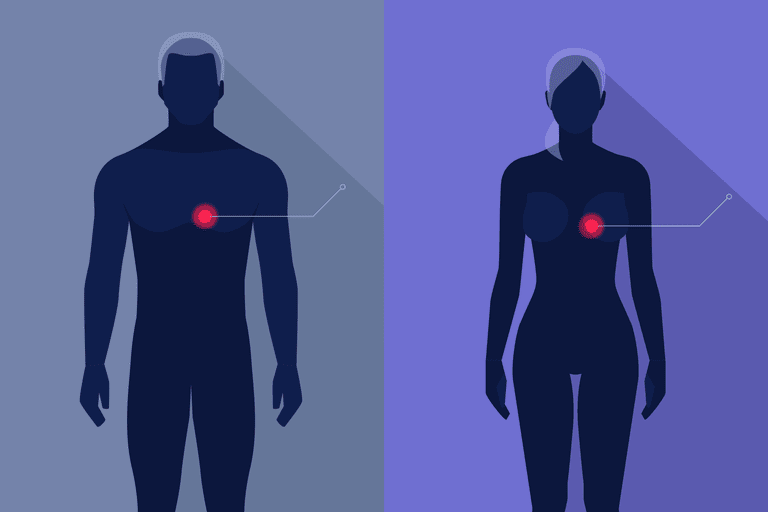 Enfermedad cardíaca: hombres vs. mujeres