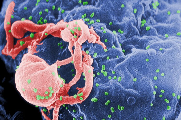 El VIH no causa el SIDA de la manera que pensamos
