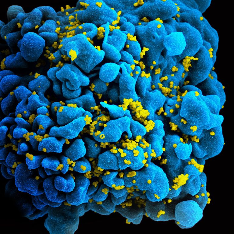 El VIH es un provirus y puede ocultarse en el ADN de las células