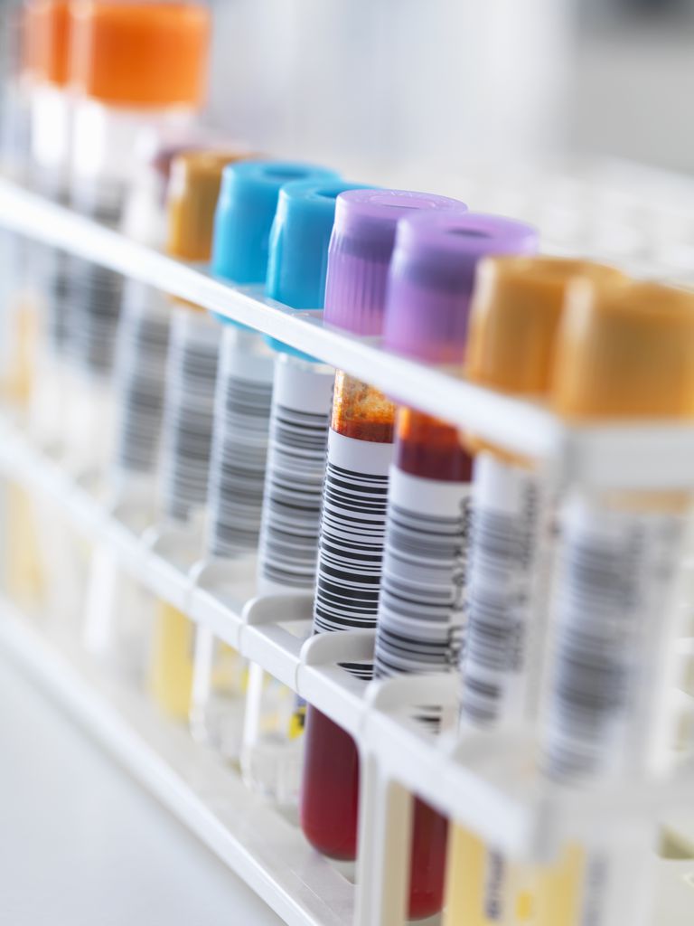 ¿Qué tan exactas son las pruebas de sangre para el herpes?