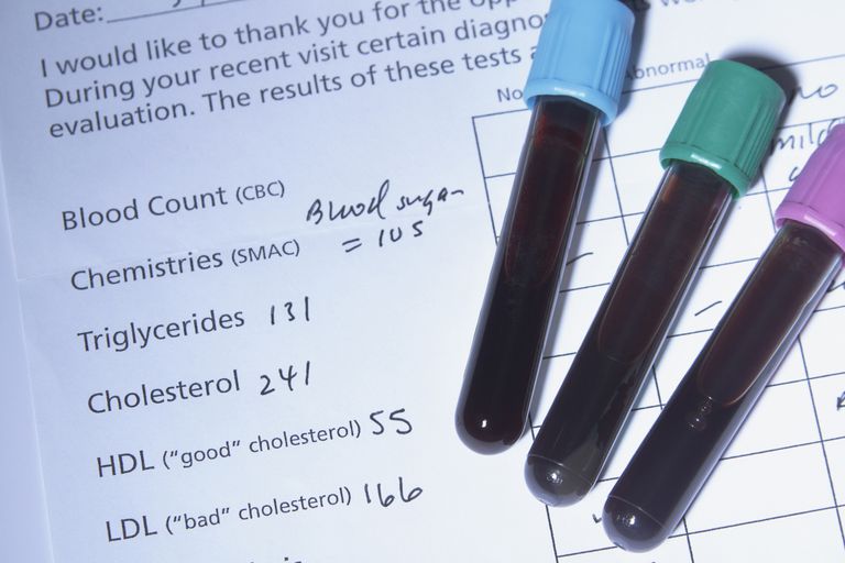 ¿En qué se diferencia la prueba de colesterol VAP?