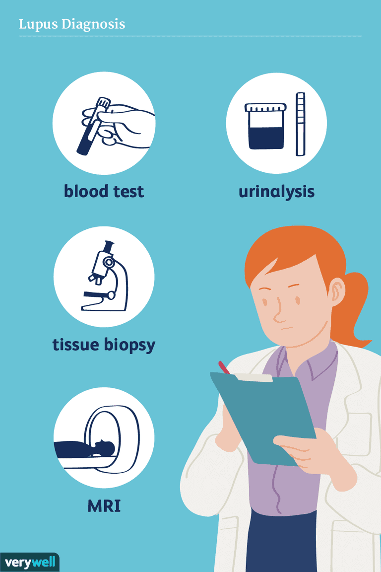 Cómo se diagnostica el lupus