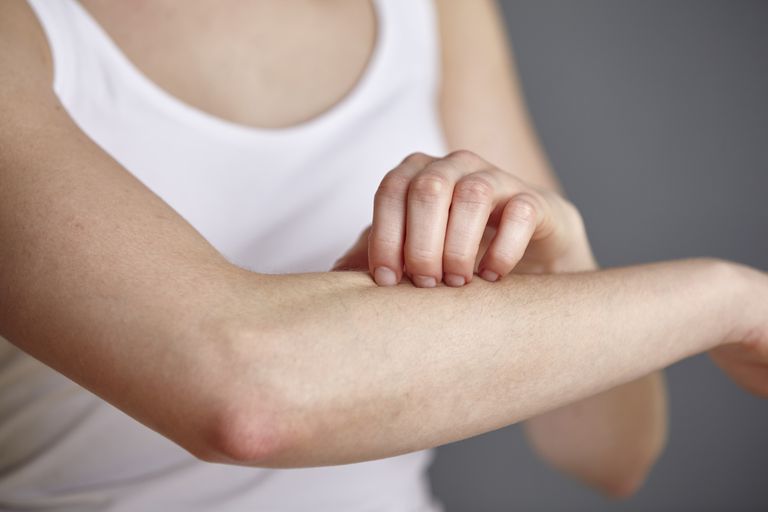 Cómo saber si necesita un dermatólogo para evaluar su problema de piel