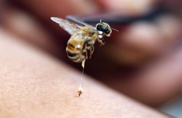 Cómo tratar a una abeja picando con seguridad