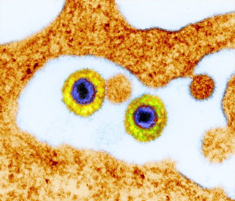 Herpes virus humano 6 (HHV-6): su papel en la enfermedad