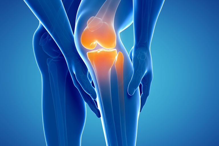 ¿Es el dolor de cadera o rodilla un síntoma de esclerosis múltiple?