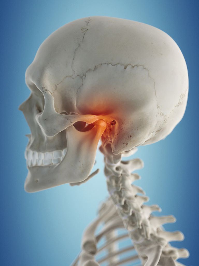 ¿Su dolor de cuello está relacionado con la articulación de la mandíbula?