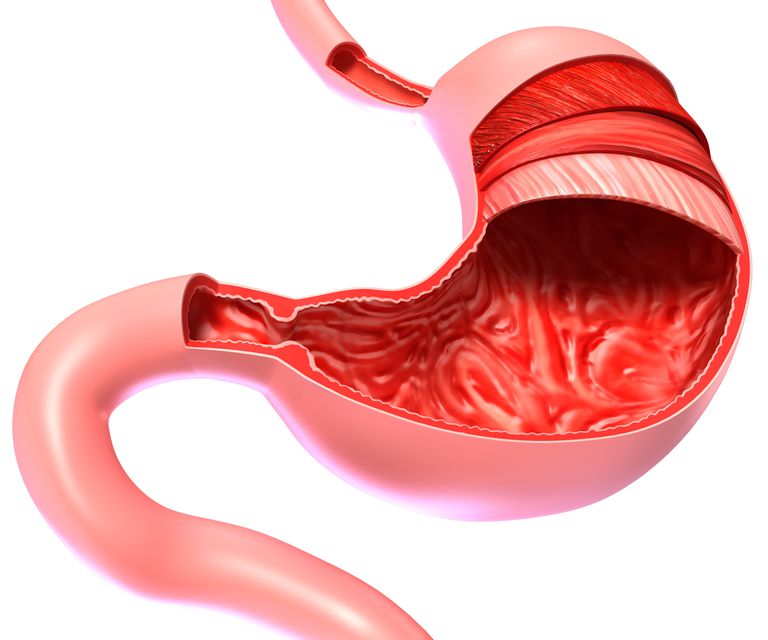 La enfermedad de Crohn puede afectar estas partes del tracto digestivo