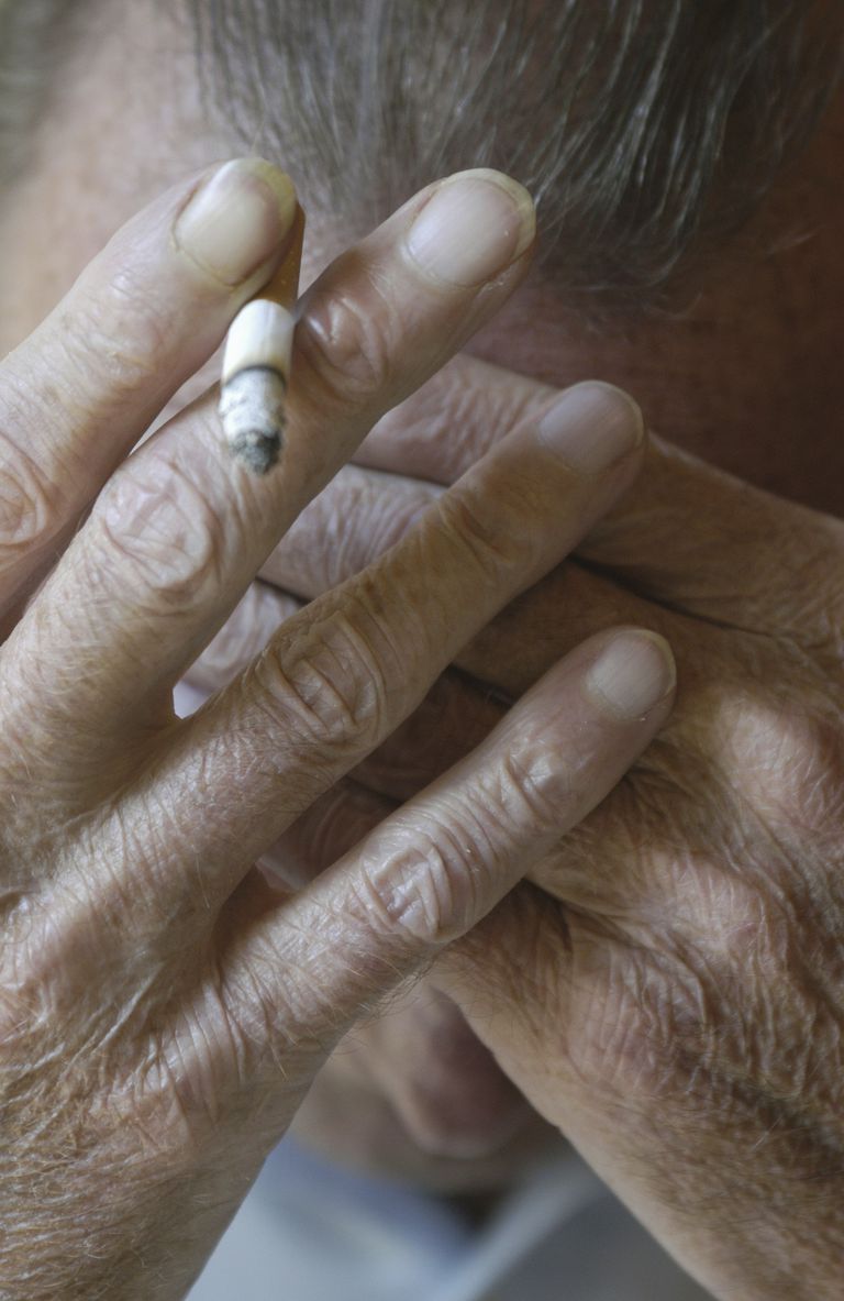 El vínculo entre fumar y el dolor crónico Pain Dolor crónico