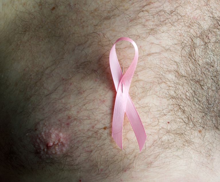 Resumen del cáncer de mama masculino