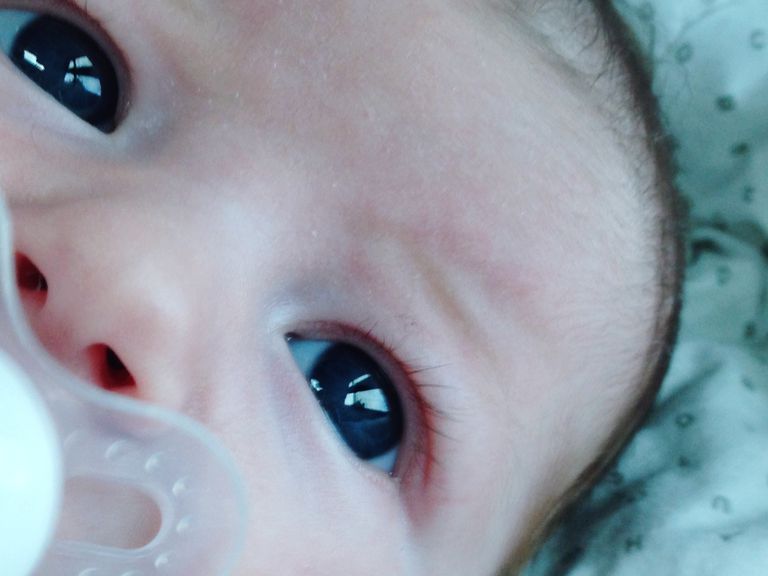 Infecciones en los ojos de los recién nacidos