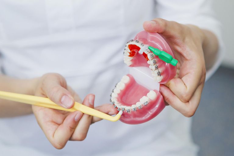 Carreras auxiliares de ortodoncista