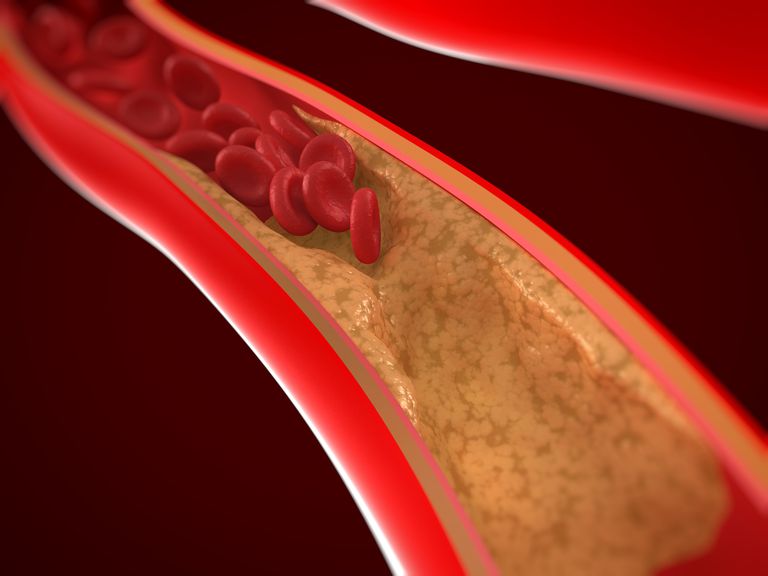 El papel de las arterias en el sistema circulatorio
