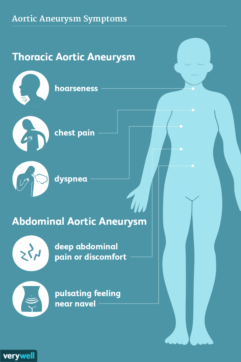 Síntomas y complicaciones del aneurisma aórtico