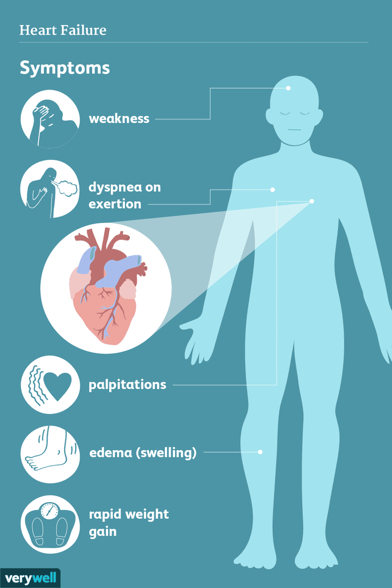 Síntomas y complicaciones de la insuficiencia cardíaca