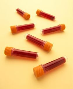 Consejos para hacer una extracción de sangre más fácil