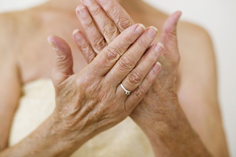 Cremas tópicas para el alivio del dolor de la artritis