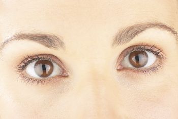 Tratamiento después de que la RAI ayude a prevenir problemas oculares