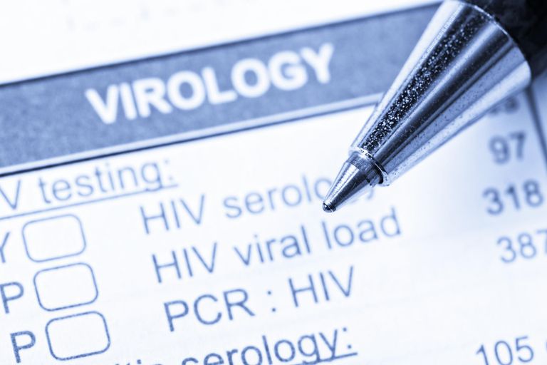 ¿Cuáles son los síntomas del VIH / SIDA en las mujeres?