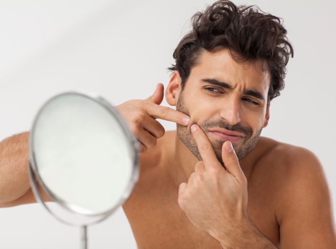 ¿Cuáles son los tipos y etapas del acné?