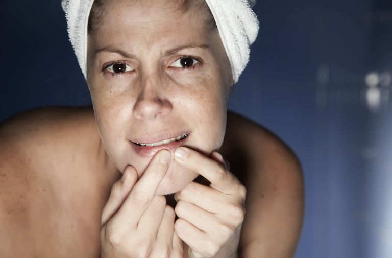 ¿Qué causa el acné en las mujeres mayores?
