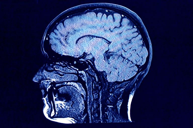 ¿Cuál es la diferencia entre CT y MRI?