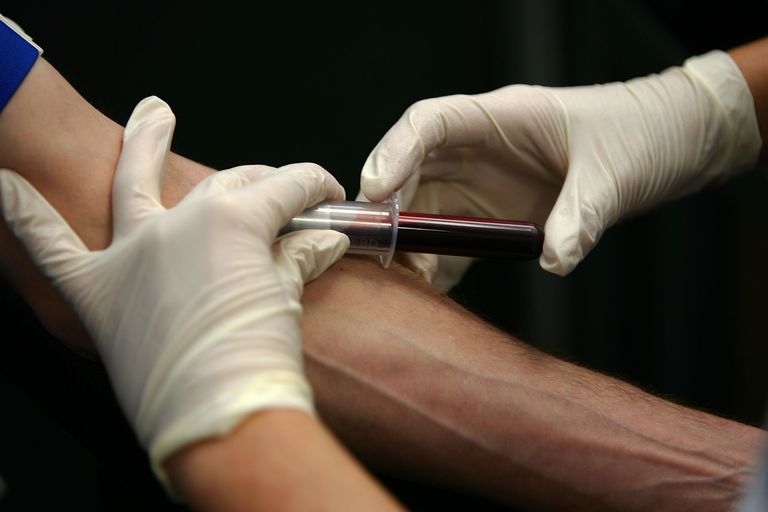 ¿Cuál es el riesgo de contraer el VIH a partir de una lesión por pinchazo de aguja?