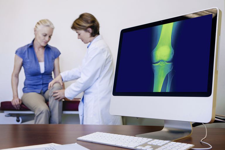 ¿Qué es la osteoartritis tricompartimental?