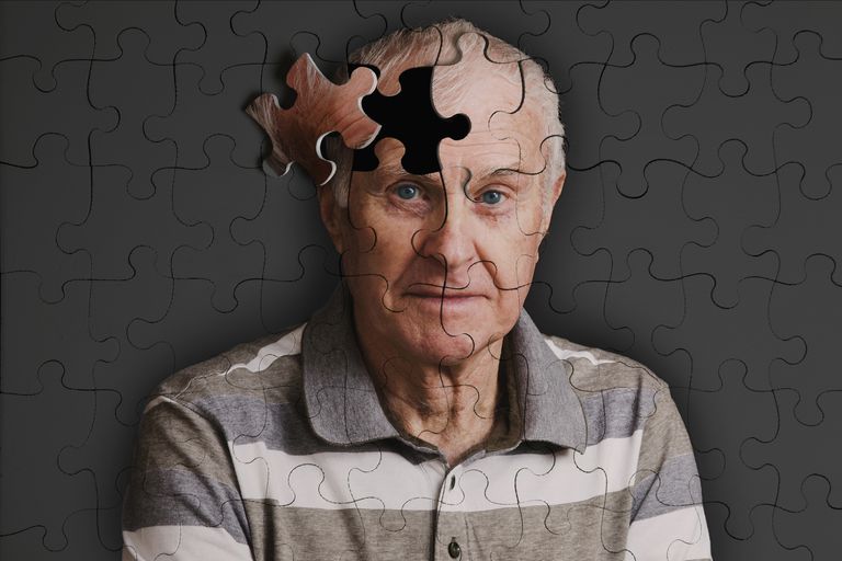 ¿Alimentará el gluten el riesgo de la enfermedad de Alzheimer o la demencia?
