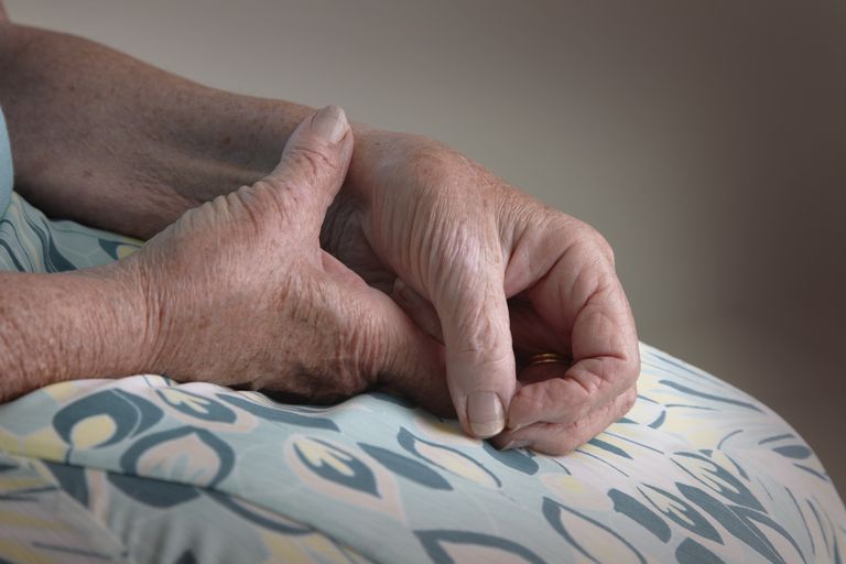 Artritis en la muñeca Causas, síntomas y tratamientos