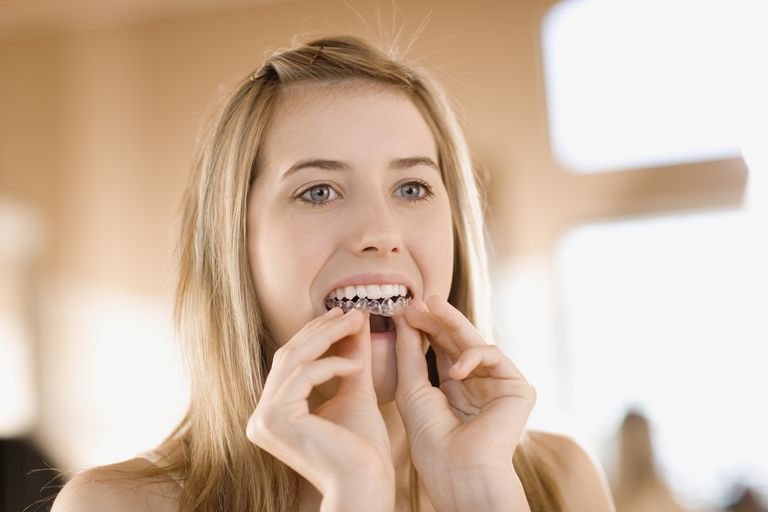 10 Estrategias para sobrellevar la sensibilidad al blanqueamiento dental