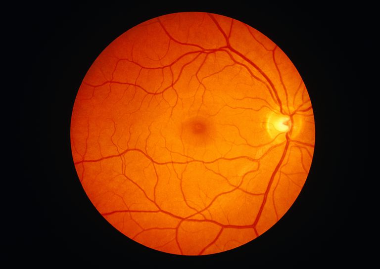 La anatomía de la retina