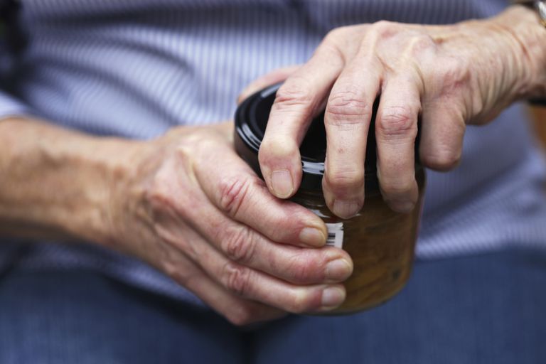 La artritis puede causar limitaciones funcionales