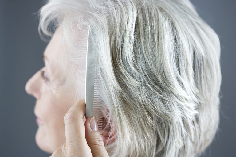 Artritis Medicamentos y pérdida de cabello