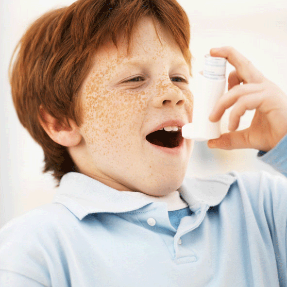 La conexión del asma y la alergia